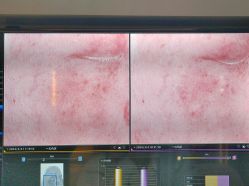 -苑苑vbeauty科技美容SPA