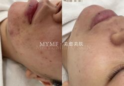 -美愈美肤MEIYU SKIN