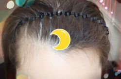 -大麦微针植发全国连锁