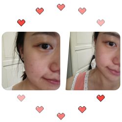 体验前-北京米扬丽格医疗美容·联合丽格鼻整形中心