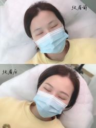 -久匠半永久纹眉