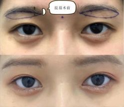 -上海漾颜医疗美容