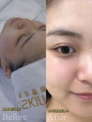 -瑾秀美肤·问题肌修护