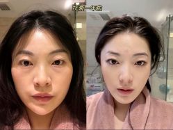 -上海伊莱美医疗美容医院