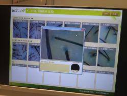 -LESSMORE科技头皮理容中心