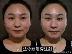 -北京米扬丽格医疗美容·联合丽格鼻整形中心