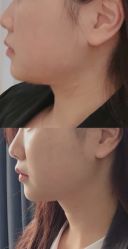 -上海漾颜医疗美容