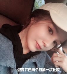 体验后-西安壹加壹医疗美容·西北抗衰旗舰店