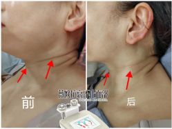点击看大图 -大唐辣妈东方塑身
