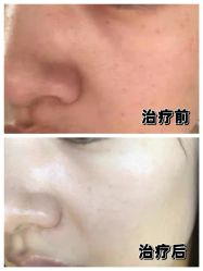 -Yestar宁波艺星整形医院