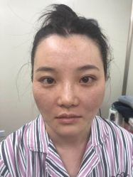 -洁铭新加坡医美