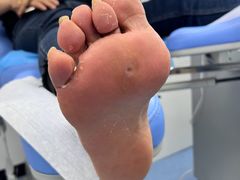 -Andrew指甲专科灰指甲·甲沟炎矫正·3D步态矫形鞋垫定制(上海法华镇路旗舰店)