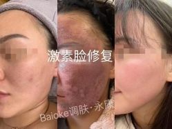 -星港国际·Skin皮肤专研·皮肤管理