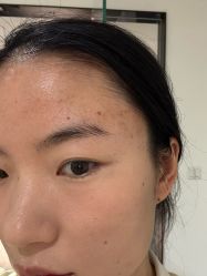-安那般那皮肤年轻化ANAPANA