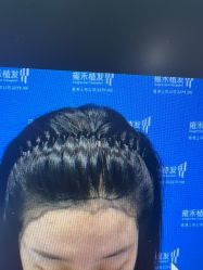 -雍禾植发全国连锁