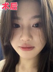 -素美医疗美容·西南眼鼻整形·修复基地