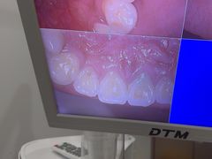 -土豆口腔(凤凰北总店)