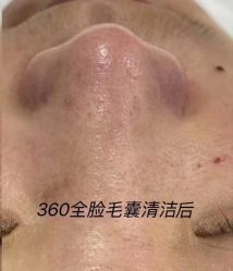 -苑苑vbeauty科技美容SPA
