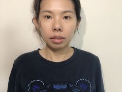 -柏乐口腔(南宁总院)