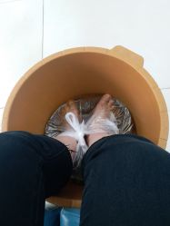 -派恩宜灰指甲鸡眼嵌甲手足癣