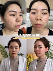 -skin79皮肤管理基站