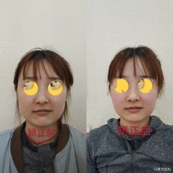 -颜和骨正·明哲式骨相美学整骨