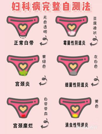 妇科炎症自测表️不做炎症女孩
