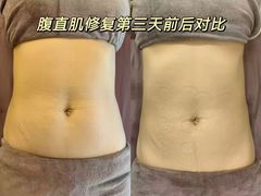 -武汉光谷K11