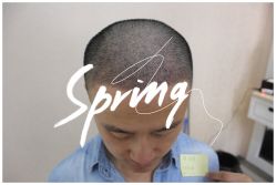 点击看大图 -大麦微针植发全国连锁