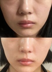 -苏州卫康美容医院