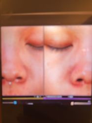 -苑苑vbeauty科技美容SPA