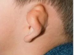 -AudioNova 海之声助听器峰力助听器索诺瓦自营店(北京店)