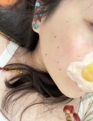 -铂特丽医美·眼鼻整形·光电美肤·注射抗衰