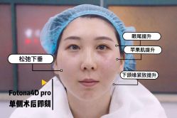 -依萱绮医疗美容