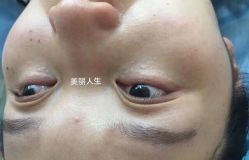 -爱莎扁平疣·汗管瘤·斑痣中心