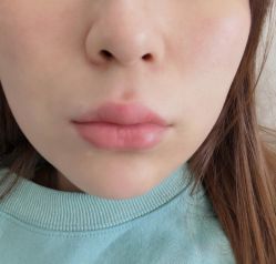 点击看大图 -深圳美莱医疗美容医院