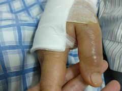 -广州中医药大学第三附属医院(骨伤科分院)