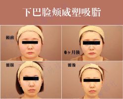 -丽都整形美容医院·全国连锁旗舰店