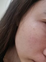 体验后-四川米兰柏羽医学美容医院