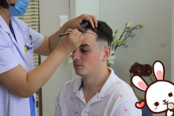 -大麦微针植发丨全国连锁