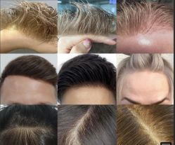 -发饰美男士增发补发假发定制店