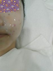 -痘院长·祛痘·皮肤管理
