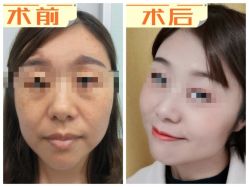 -素美医疗美容·西南眼鼻整形·修复基地