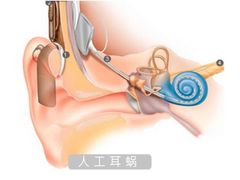 -AudioNova 海之声助听器峰力助听器索诺瓦自营店(北京店)