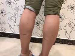 -新美荟医美·专注面部美学抗衰