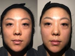 -安吉拉青春化管理中心