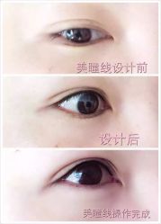 -尚玲纹绣纹眉特价店