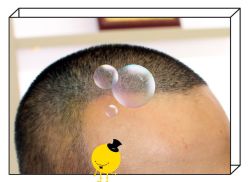 -大麦微针植发全国连锁