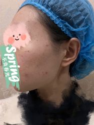 体验前-南京医科大学友谊整形外科医院