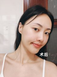 -广州美莱医疗美容医院